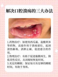 儿童口腔溃疡护理：饮食忌口，止痛愈合方法​